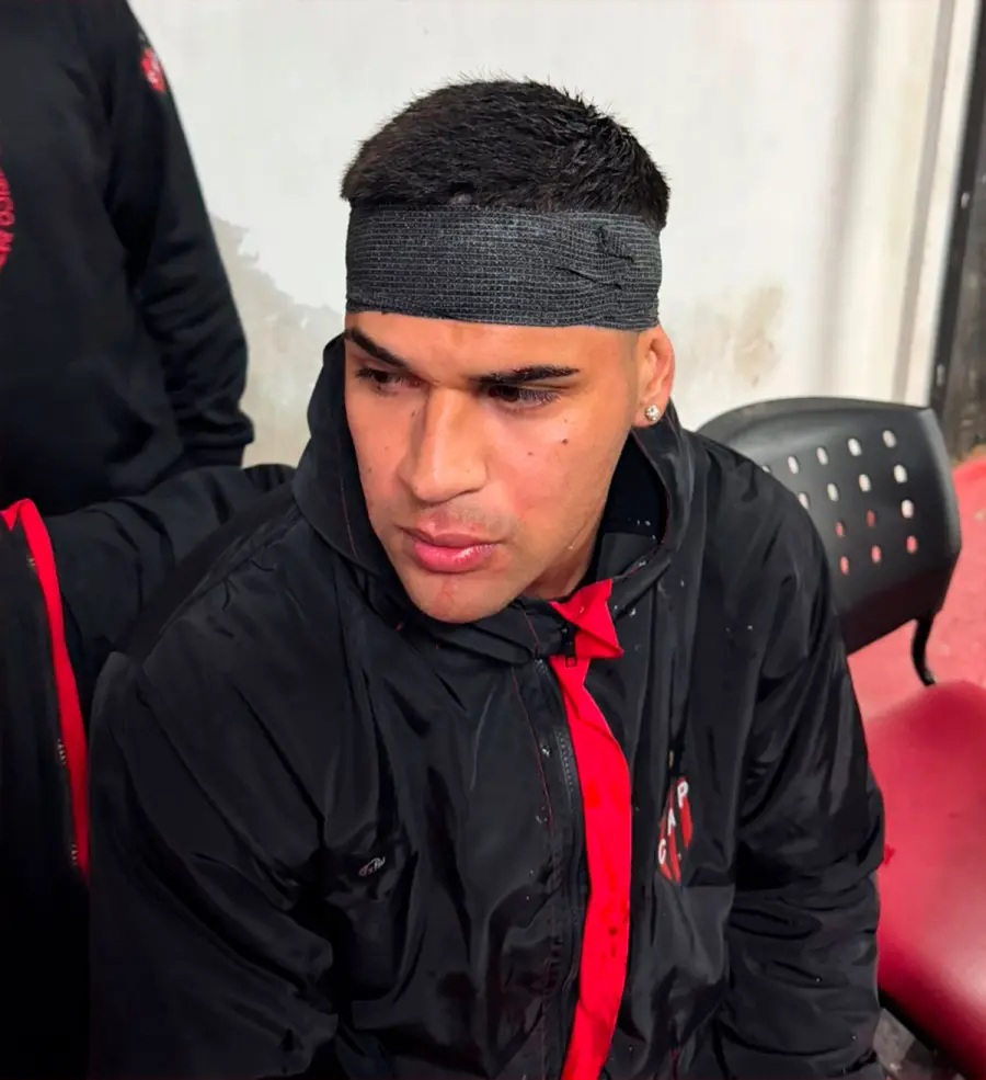 Facundo Díaz, sufrió un corte en la cabeza. (Foto: Gabriel Obelard)