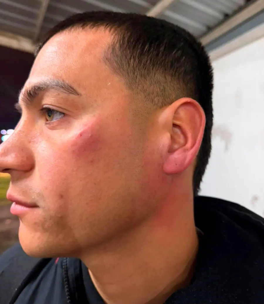 El rostro del capitán, Alan Sosa. (Foto: Gabriel Obelard)