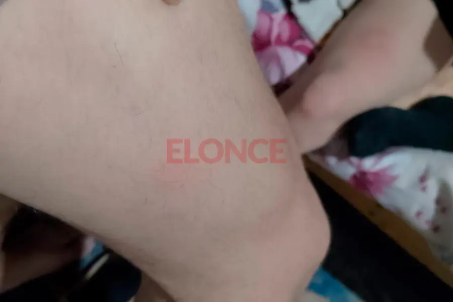 Golpeados por la granizada en Aldea Santa Mar&iacute;a (foto Elonce)