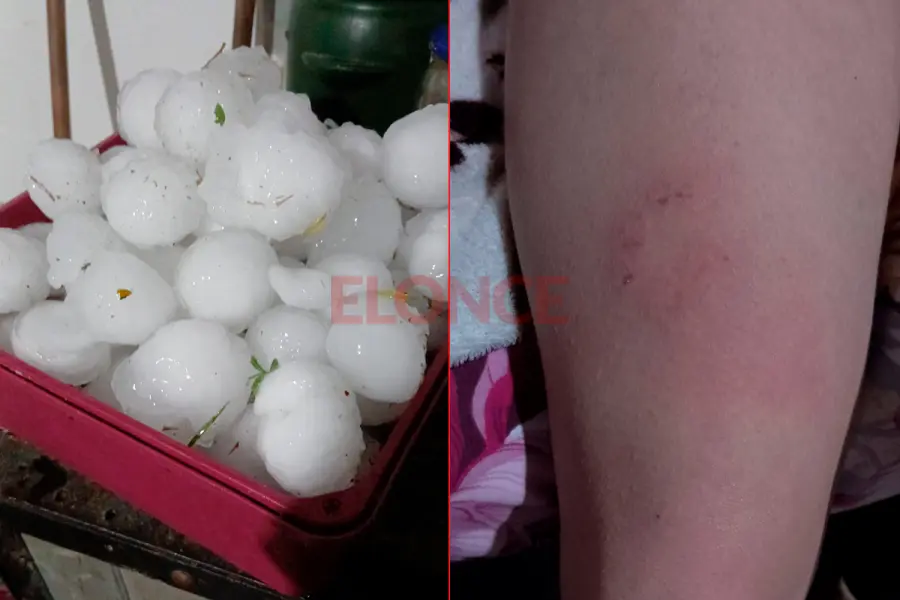 Golpeados por la granizada en Aldea Santa Mar&iacute;a (foto Elonce)