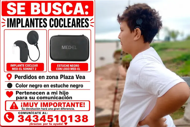 Un niño perdió los implantes que necesita para oír, engañaron a su madre al intentar recuperarlos y piden ayuda
