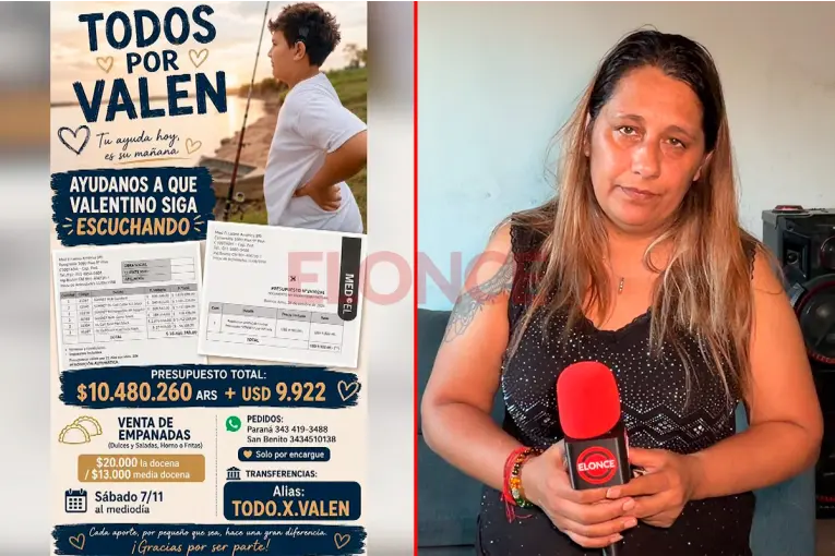 “Empecé con lo poco que tengo”: una madre busca reunir $26 millones para los implantes de su hijo